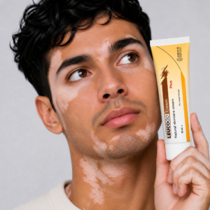 Leucogo Plus  Cream For Vitiligo