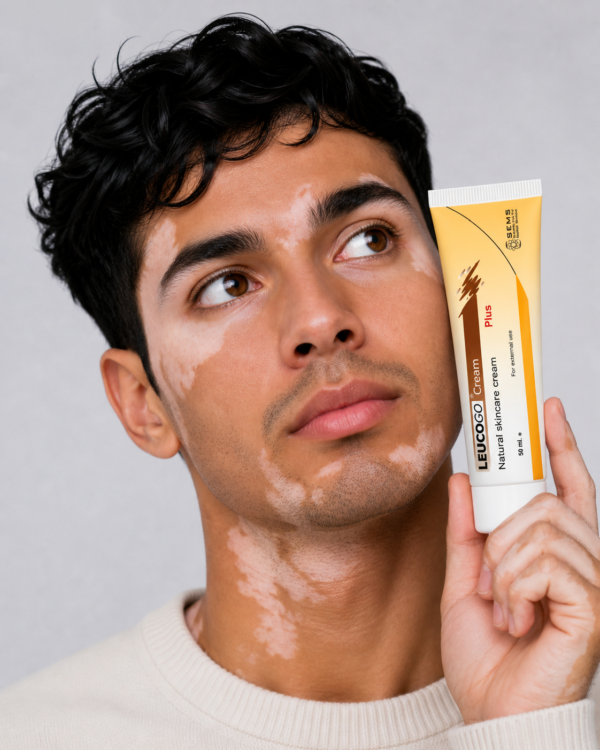 Leucogo Plus  Cream For Vitiligo